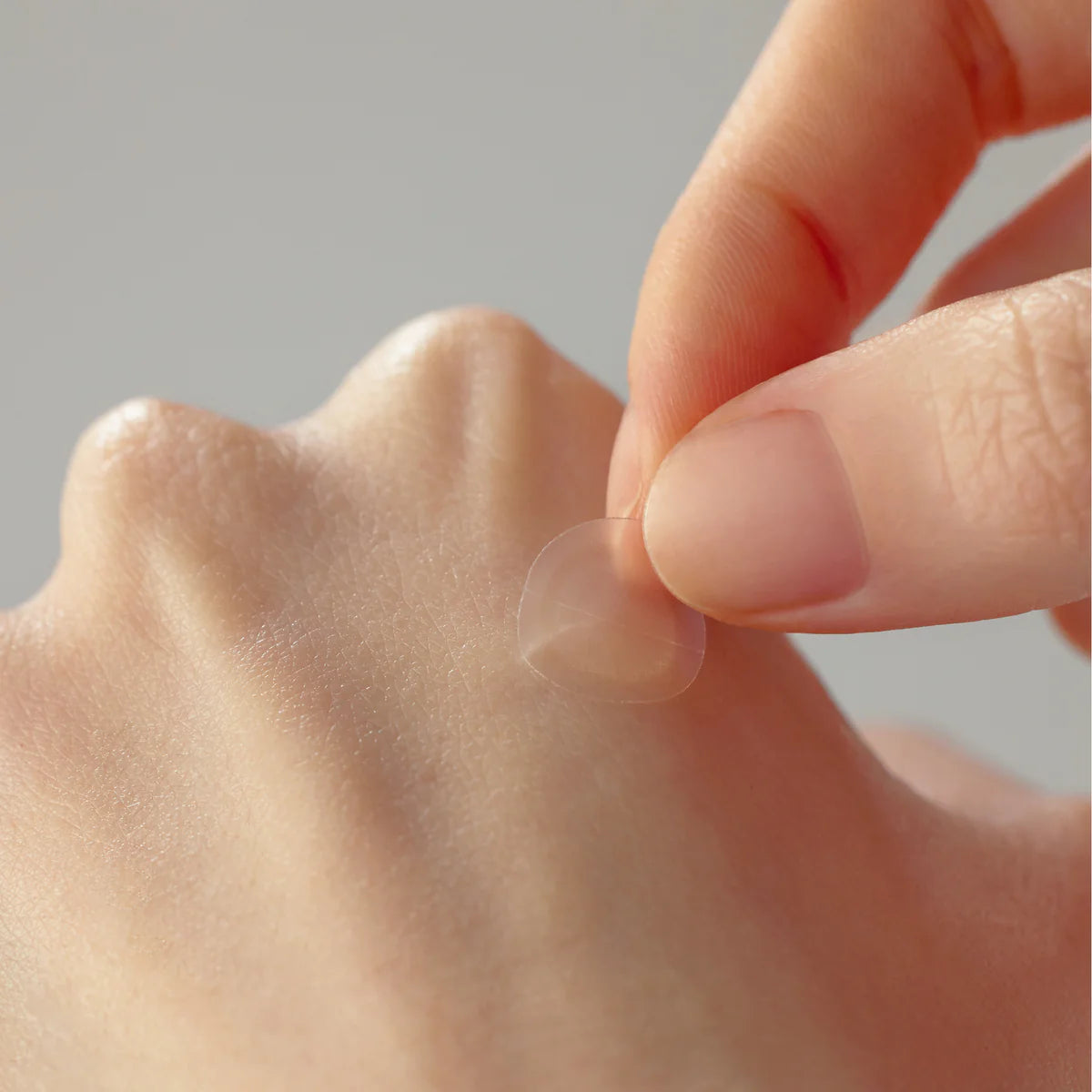 Applying SOME BY MI 30 Days Miracle Clear Spot Patch on skin, showcasing its clear and discreet design for acne healing.